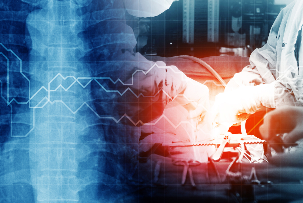 Strong Rally on Israeli Stock Market Wise Money Israel